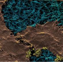 Diamond-studded silk wound dressing detects infection and improves