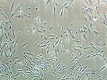 Image: Olfactory neurosphere cells taken from the body, analysed for subtle differentiation of colour.