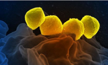 Image: Scanning electron micrograph of Group A Streptococcus bacteria on primary human neutrophil.