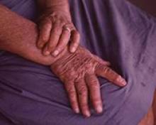Image: Elderly resident