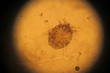 Image: Seven-year itch mite: Light microscopy image of a Sarcoptes scabiei, the mite that causes scabies (seven-year itch). Image ID 104672480, Shutterstock.