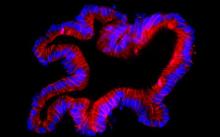 Fuorescent pictures of a human colon organoid stained for E-cadherin in red and DAPI in blue. CREDIT Dr Thierry Jarde Fuorescent pictures of a human colon organoid stained for E-cadherin in red and DAPI in blue. CREDIT Dr Thierry Jarde