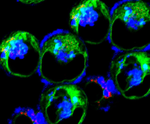 an image of the inflammatory dendritic cells that come in as a consequence of inflammation to mount an immune response an image of the inflammatory dendritic cells that come in as a consequence of inflammation to mount an immune response