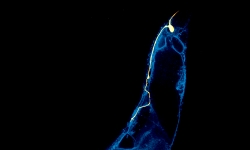 The tail of a nematode C. elegans, in which the main posterior mechanosensory neuron is highlighted