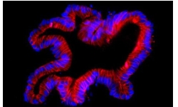 Fuorescent pictures of a human colon organoid stained for E-cadherin  in red and DAPI in blue. Credit: Dr Thierry Jarde