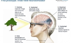 diagram of the bionic eye.