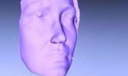 Image: Depiction of 3D analysis for facial rejuvenation procedures.