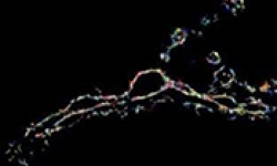 Image: Protein essential for neuronal communication viewed via super-resolution microscopy.