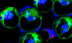 an image of the inflammatory dendritic cells that come in as a consequence of inflammation to mount an immune response
