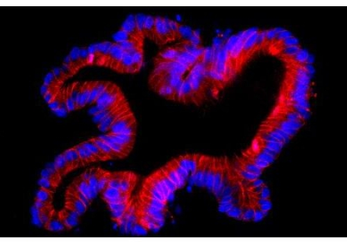 Fuorescent pictures of a human colon organoid stained for E-cadherin  in red and DAPI in blue. Credit: Dr Thierry Jarde