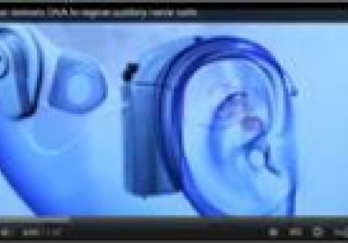 Image: Bionic Ear