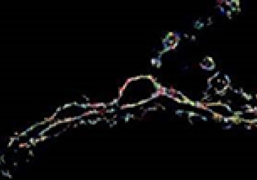 Image: Protein essential for neuronal communication viewed via super-resolution microscopy.
