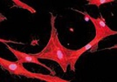 Image: Mesenchymal stem cells derived from adipose tissue can grow on nanoscale plastic surfaces.