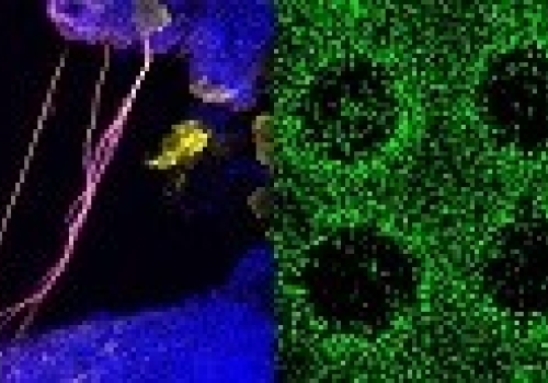 Delicate neurones created by 3D printing; and, right: iPSC-laden bioink formed in scaffolds containing stem cells Delicate neurones created by 3D printing; and, right: iPSC-laden bioink formed in scaffolds containing stem cells