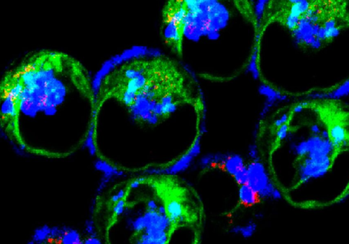 an image of the inflammatory dendritic cells that come in as a consequence of inflammation to mount an immune response an image of the inflammatory dendritic cells that come in as a consequence of inflammation to mount an immune response